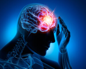 Why Choose Mercado Kramer, LLP After a Brain Injury in Monterey County, CA?